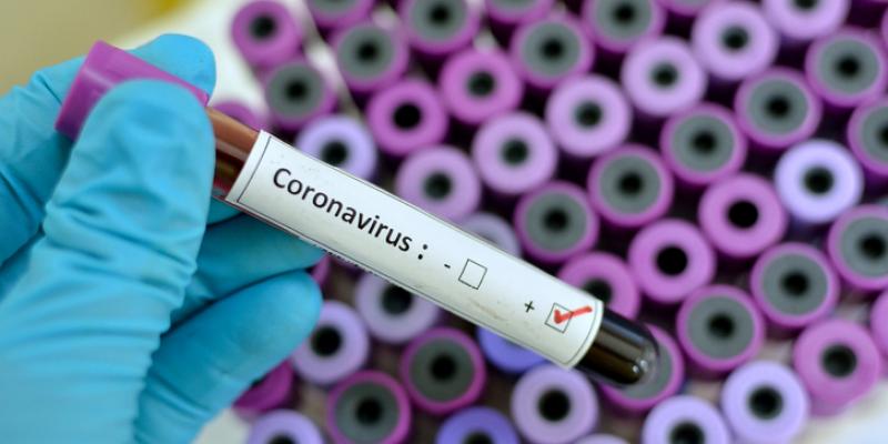 Coronavirus