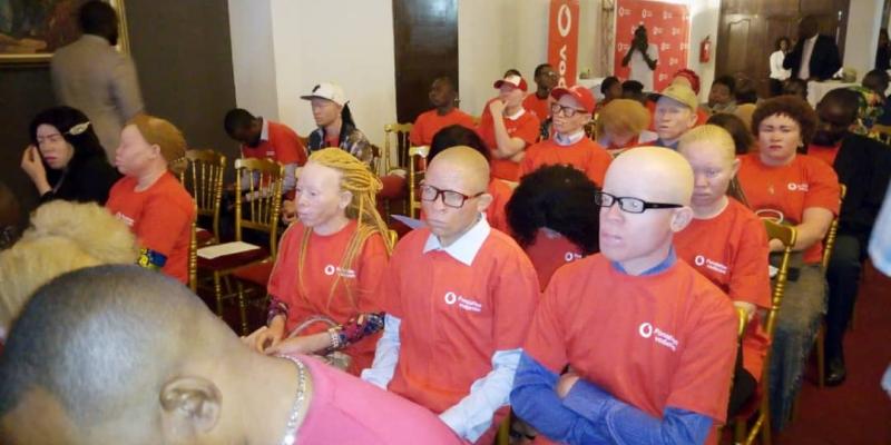 Les albinos de Kinshasa encadrés par une association locale 